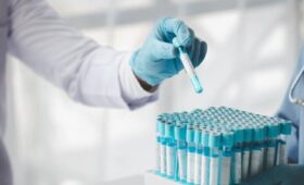 Российские легкоатлеты Зубковы дисквалифицированы за отказ сдать допинг-пробы