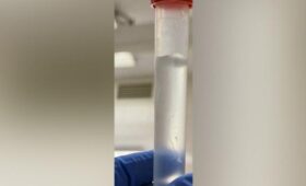 Живой червь-паразит был обнаружен в глазу у жительницы Омска