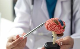 Академик РАН Иллариошкин посоветовал после 40 лет регулярно обследовать мозг