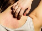 Ученые предупредили об опасном грибке, который распространяется по Европе