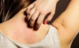 Ученые предупредили об опасном грибке, который распространяется по Европе