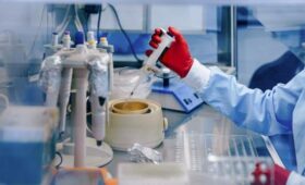 Роспотребнадзор взял на контроль сообщения о вспышке вируса Марбург в Эфиопии