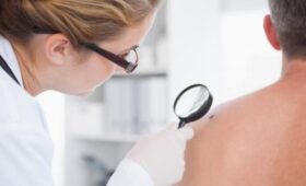 Врач Скорогудаева: самостоятельное удаление родинок может спровоцировать опухоль