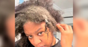 Американка обнаружила в волосах моль после того, как не мыла их год