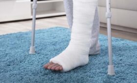 Юрист Шайдуллина: полученная на корпоративе травма не является производственной