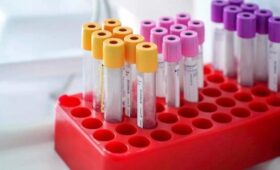 Вирусолог Нетесов: существует 5 опасных инфекций на популярных тропических курортах