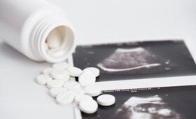 В РПЦ призвали сократить сроки аборта до 9 недель для поддержки рождаемости