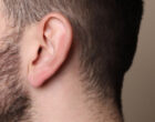 Мужчины в России начали чаще уменьшать грудь и менять форму ушей