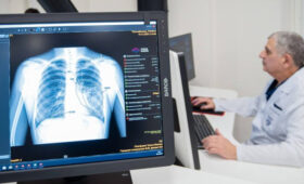 Минздрав: пациенты с ВИЧ и туберкулезом получают медпомощь в РФ бесплатно