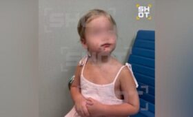 SHOT: девочка заразилась кожной инфекцией после укуса комара на Бали