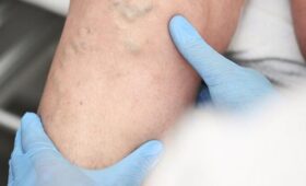 Диетолог Русакова: чипсы и сливочное масло повышают риск образования тромбов