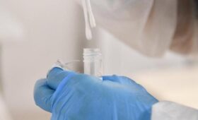 Роспотребнадзор создаст еще 50 тест-систем для выявления инфекций