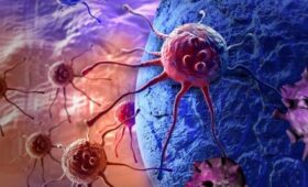 Академик Каприн: 54% новых случаев рака в России выявляется у женщин