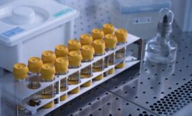 В Роспотребнадзоре заявили о сохранении рисков распространения холеры в мире